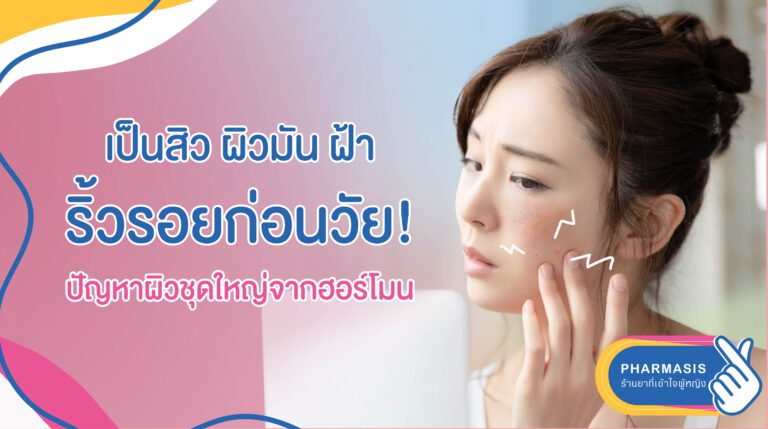 เป็นสิว ผิวมัน ฝ้า ริ้วรอยก่อนวัย! ปัญหาผิวชุดใหญ่จากฮอร์โมน