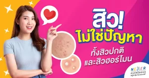 สิวไม่ใช่ปัญหา! วิธีดูแลผิวให้ใสไร้สิว ทั้งสิวปกติและสิวฮอร์โมน