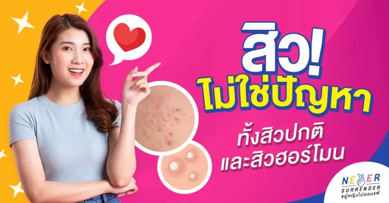 สิวไม่ใช่ปัญหา! วิธีดูแลผิวให้ใสไร้สิว ทั้งสิวปกติและสิวฮอร์โมน