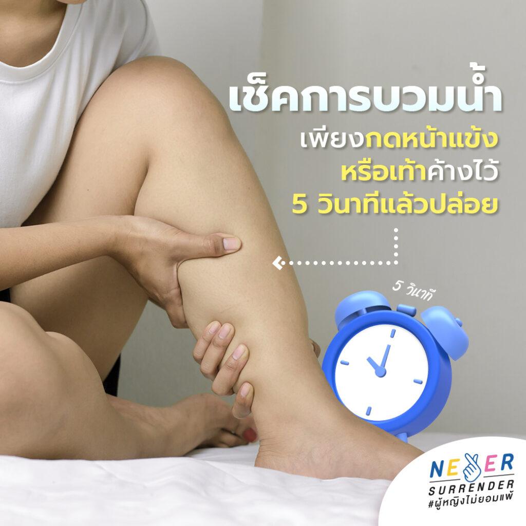 เช็คอาการบวมน้ำ เพียงกดหน้าแข้ง หรือเท้าค้างไว้ 5 วินาทีแล้วปล่อย
