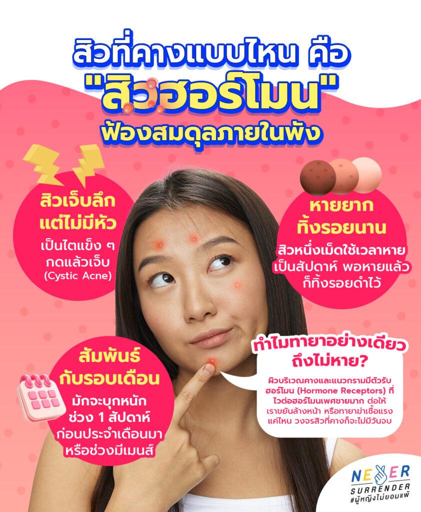 สิวที่คางแบบไหน คือ "สิวฮอร์โมน" ฟ้องสมดุลภายในพัง สิวเจ็บลึกแต่ไม่มีหัว เป็นไตแข็งๆ กดแล้วเจ็บ (cystic acne)
หายยากทิ้งรอยนาน สิวหนึ่งเม็ดใช้เวลาหายเป็นสัปดาห์ พอหายแล้วทิ้งรอยดำไว้
สัมพันธ์กับรอบเดือน มักจะบุกหนักช่วง 1 สัปดาห์ก่อนประจำเดือนมา หรือช่วงมีเมนส์
ทำไมทายาอย่างเดียวถึงไม่หาย?
ผิวบริเวณคาง และแนวกรามมีตัวรับฮอร์โมนเพศชายมาก ต่อให้เราขยันล้างหน้าหรือทายาฆ่าเชื้อแรงแค่ไหน วงจรสิวที่คางก็จะไม่มีวันจบ